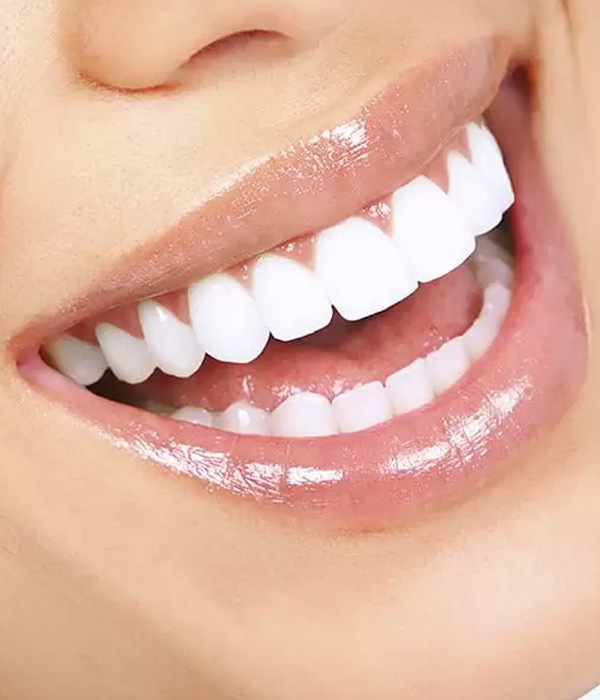 Dientes blancos